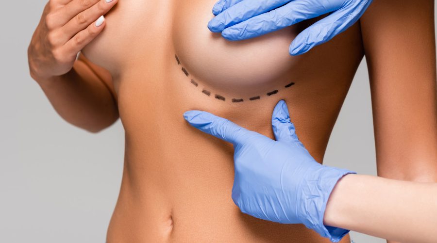 breast breast